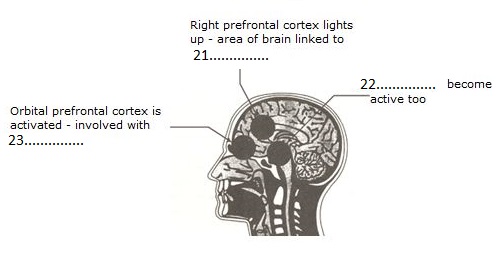 Brain activated by jokes 